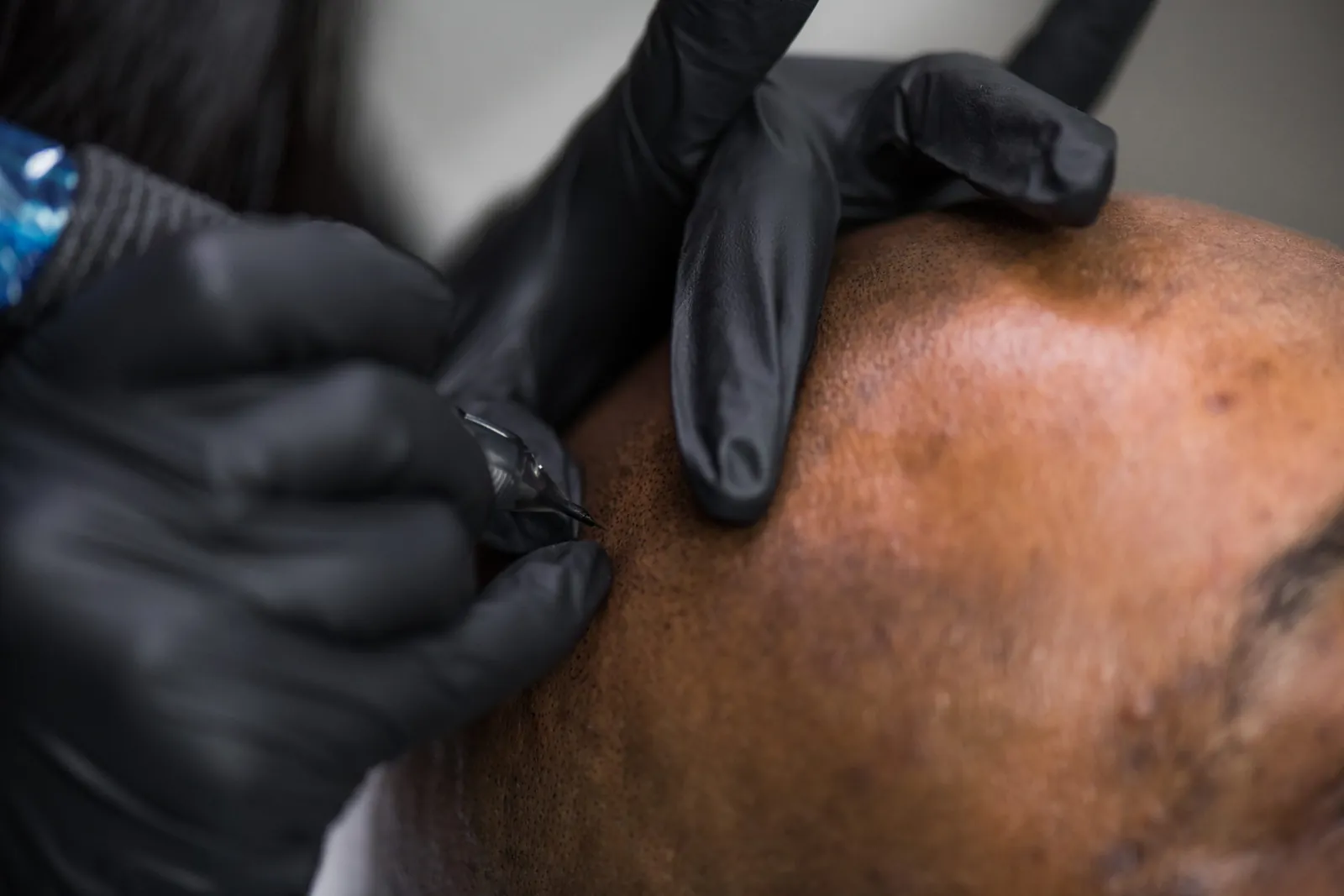 SMP artist applying pigment to a client's scalp during a scalp micropigmentation session