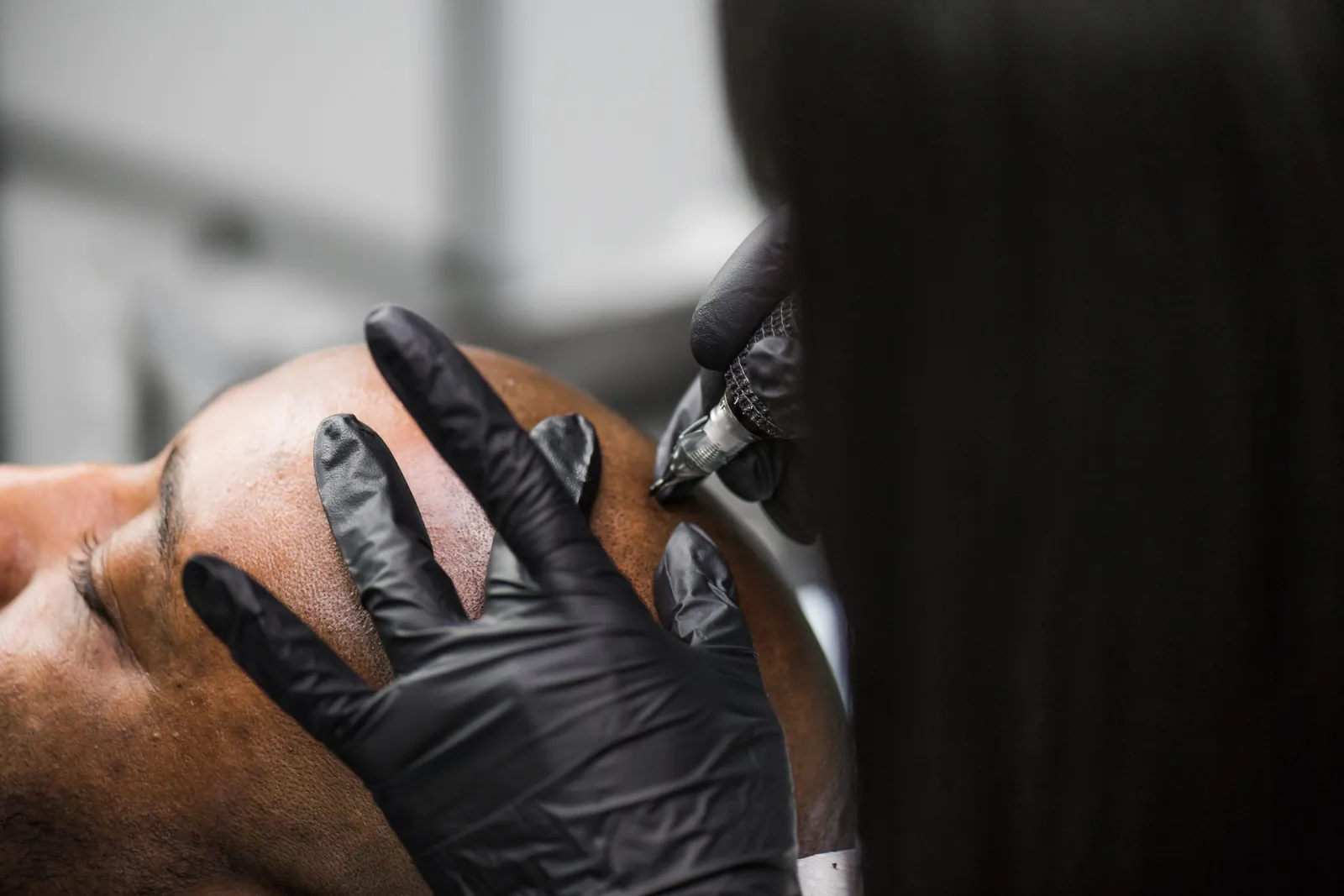 Close-up of a scalp micropigmentation pen applying pigment impressions to a scalp