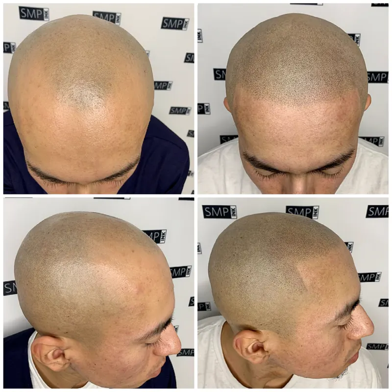Scalp micropigmentation and permanent makeup client result from the SMP INK Seattle gallery