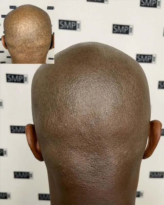 Scalp micropigmentation and permanent makeup client result from the SMP INK Seattle gallery