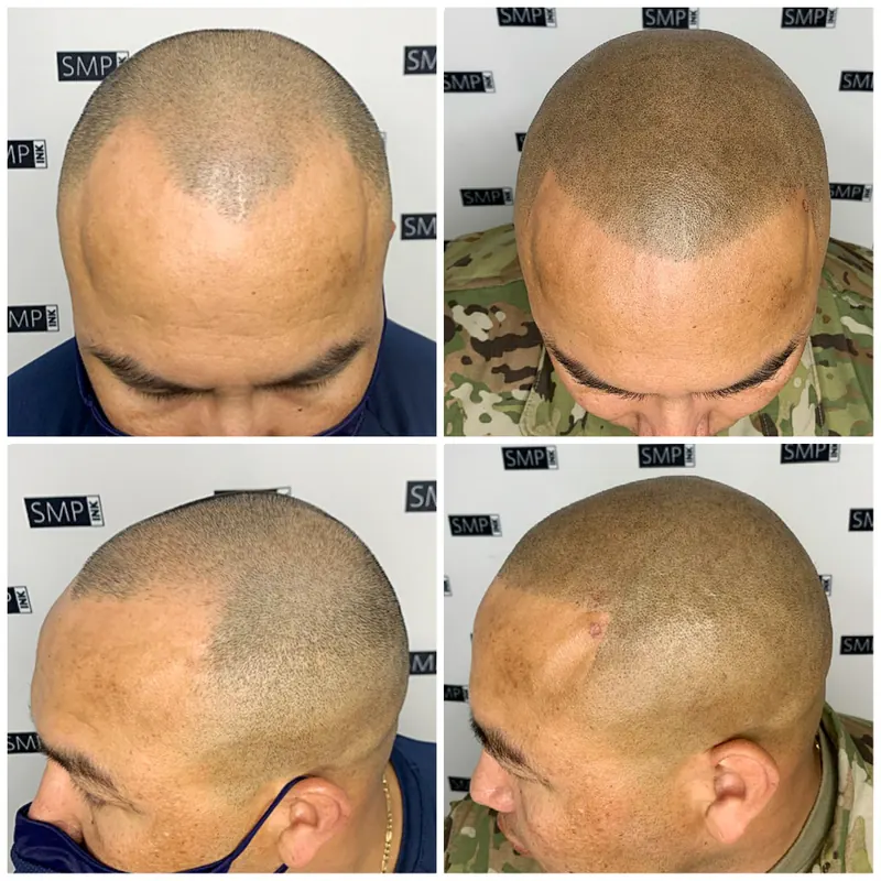 Scalp micropigmentation and permanent makeup client result from the SMP INK Seattle gallery