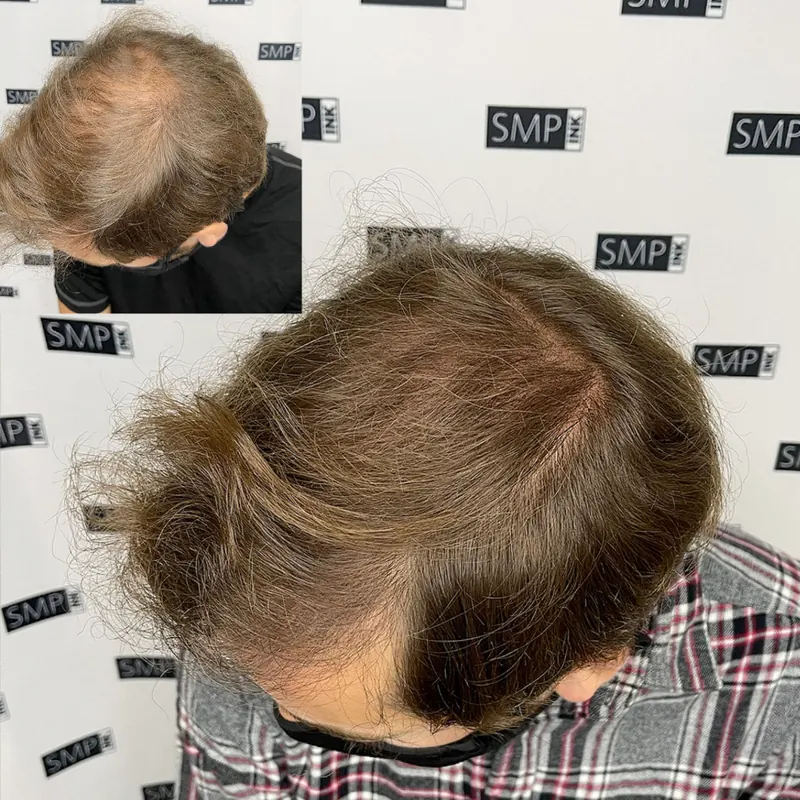 Scalp micropigmentation and permanent makeup client result from the SMP INK Seattle gallery