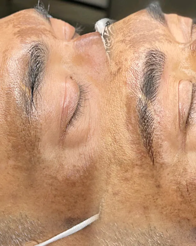 Scalp micropigmentation and permanent makeup client result from the SMP INK Seattle gallery