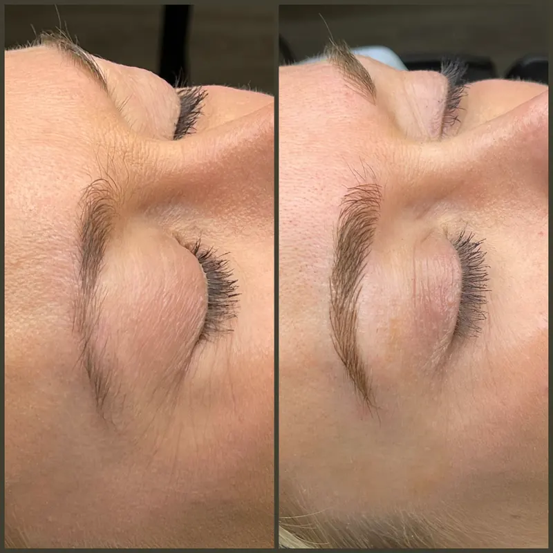 Scalp micropigmentation and permanent makeup client result from the SMP INK Seattle gallery