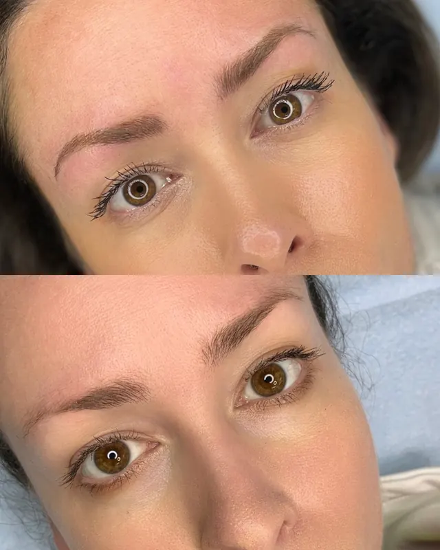 Scalp micropigmentation and permanent makeup client result from the SMP INK Seattle gallery