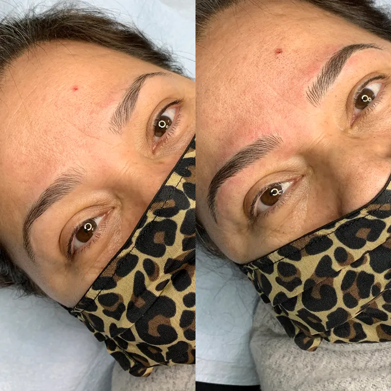 Scalp micropigmentation and permanent makeup client result from the SMP INK Seattle gallery