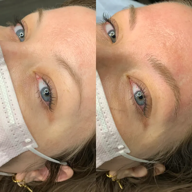 Scalp micropigmentation and permanent makeup client result from the SMP INK Seattle gallery