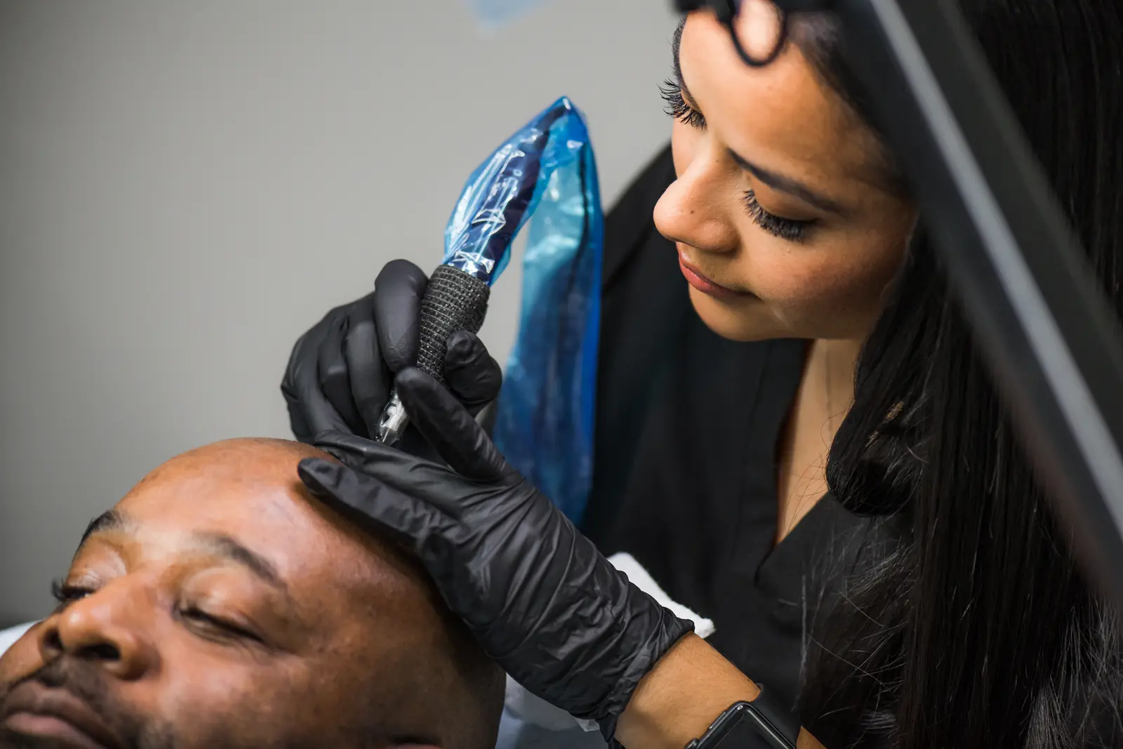 SMP artist in black gloves performing scalp micropigmentation on a client