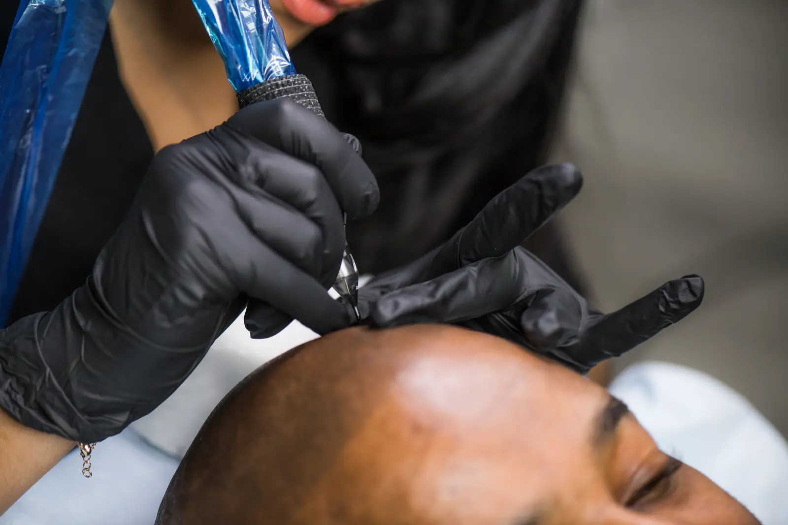 Close-up of a gloved SMP artist working on a client's hairline